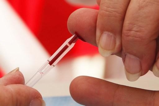 Preventive treatment against AIDS virus tested successfully in Belgium