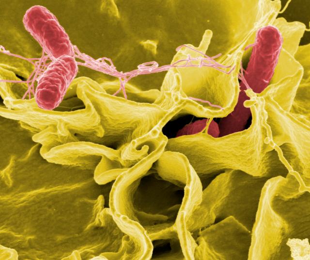 Bruges school hit with possible salmonella infection
