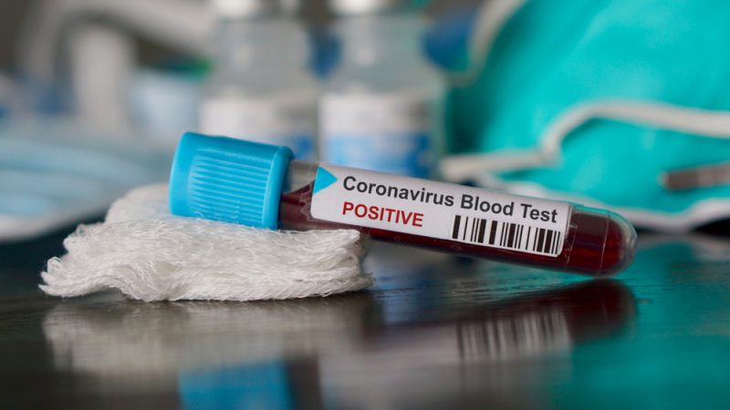 Over 8% of Belgian healthcare workers present Covid-19 antibodies