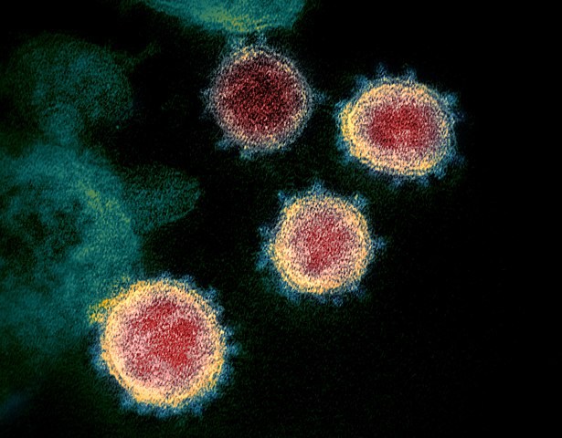 Cheap and generic steroid is first 'life-saving' coronavirus drug