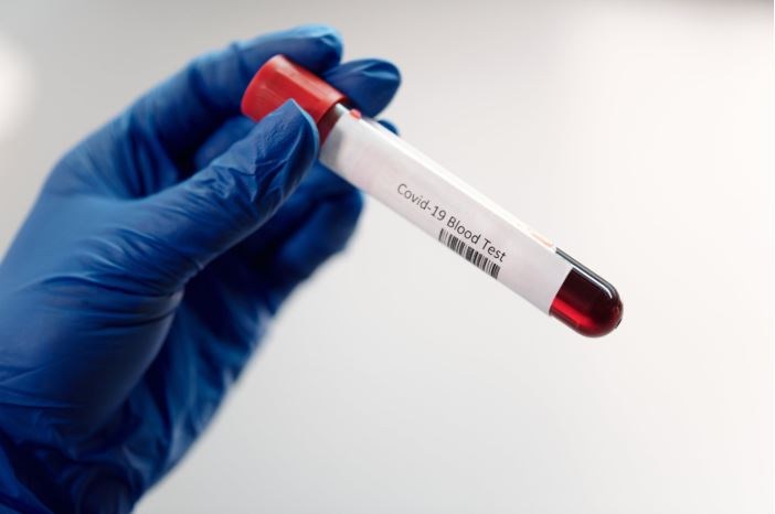 Coronavirus: antibody tests for everyone 'soon' available via GPs