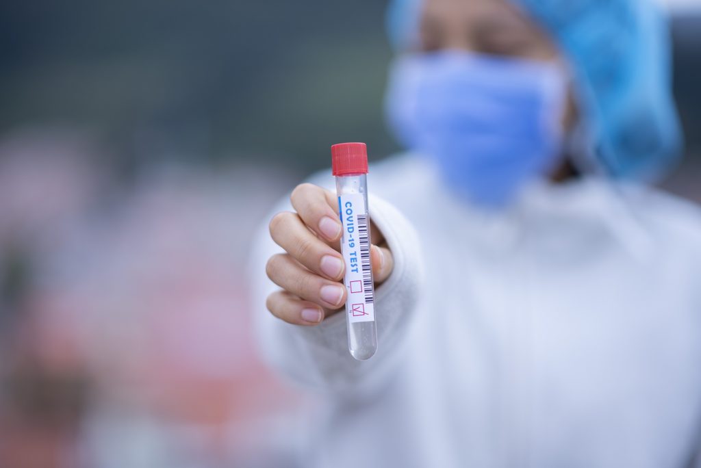 Coronavirus: US approves Swiss antibody test