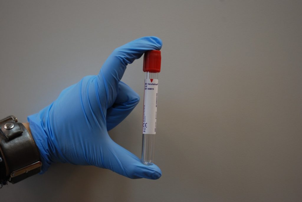 Hundreds of Belgians volunteer for corona vaccine tests