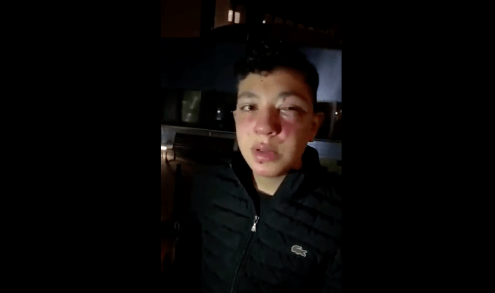 Police investigate allegations of brutality against Brussels teen