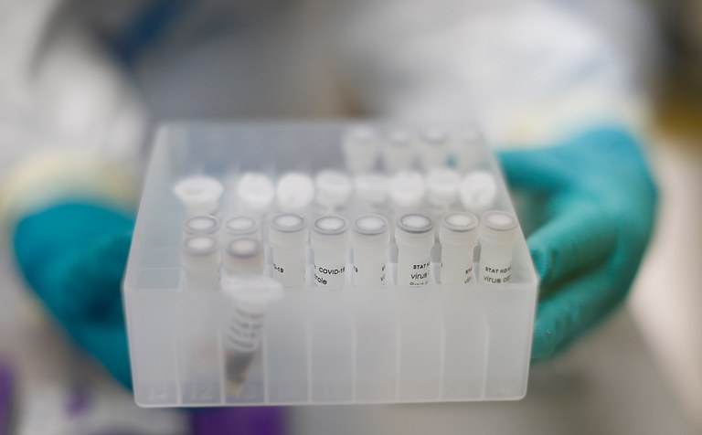 KU Leuven to test coronavirus vaccine on humans this year
