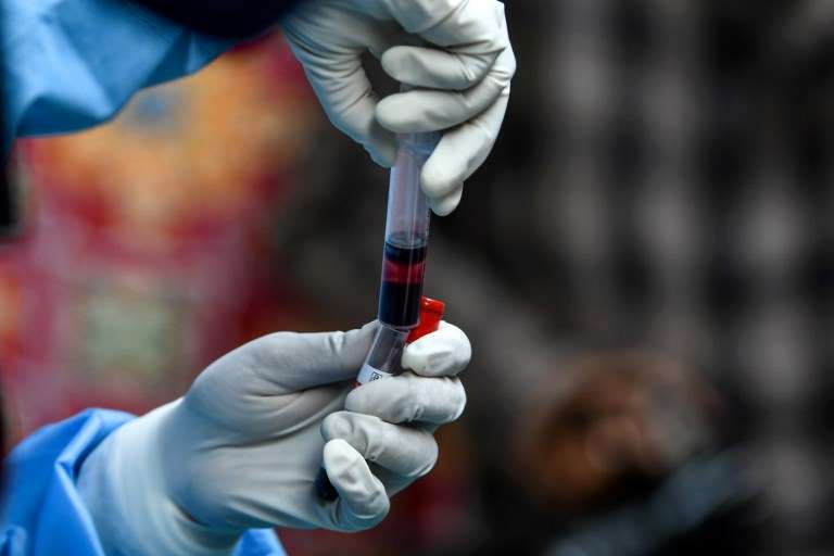 Coronavirus plasma treatment 'not without danger', Belgian expert says