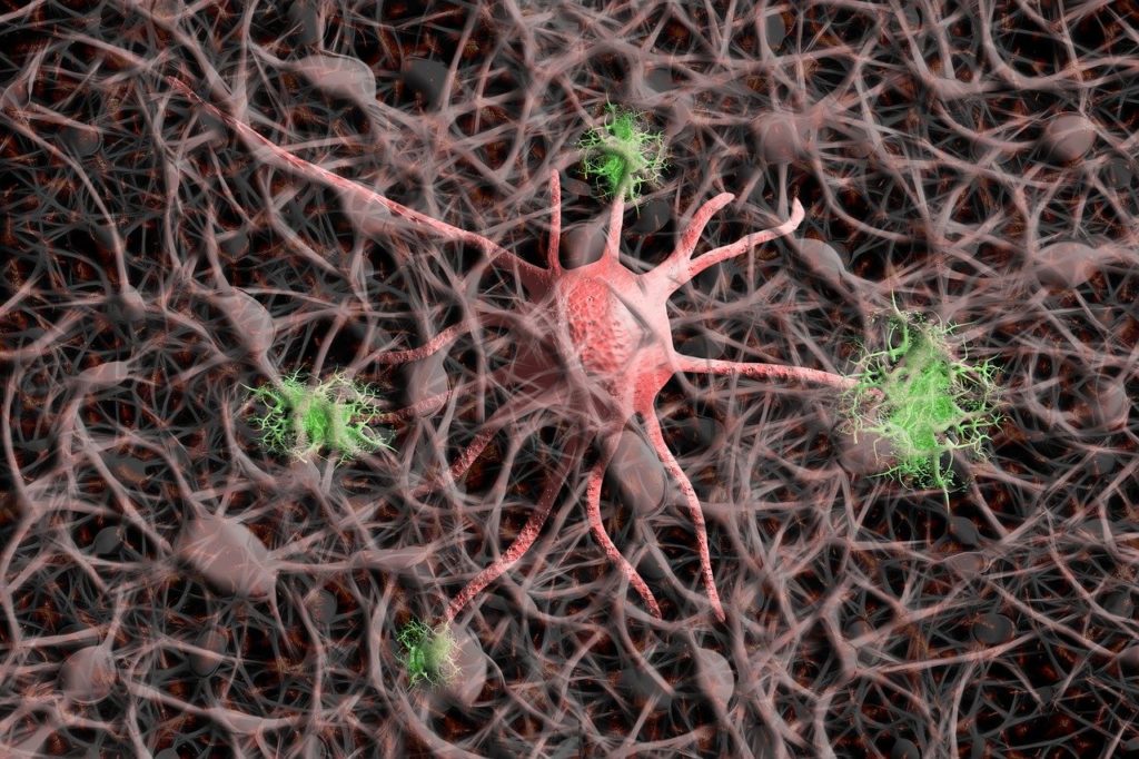 Belgian-led team discovers a possible key to Alzheimer’s