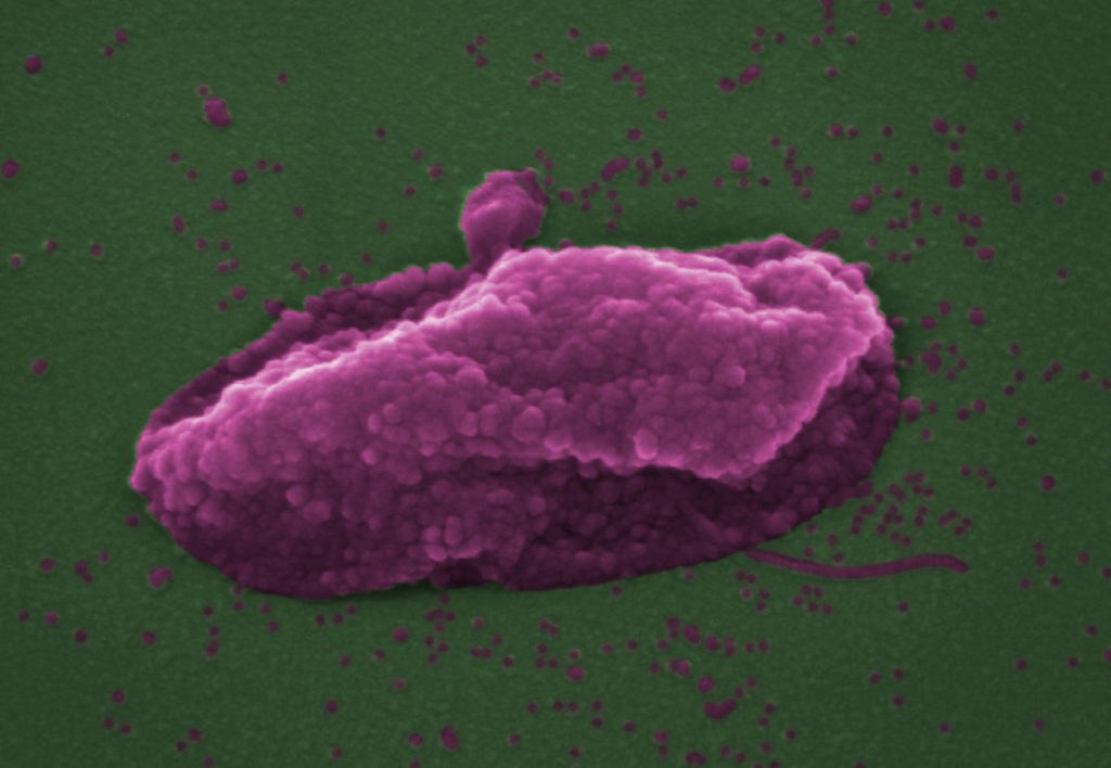 Research: ‘Last resort’ antibiotic bursts bacteria like a balloon