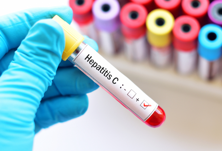 First case of mysterious acute hepatitis in children in Belgium