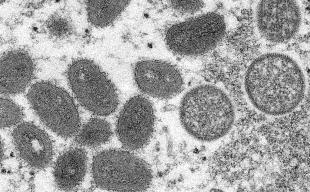 Ninth monkeypox case confirmed in Belgium