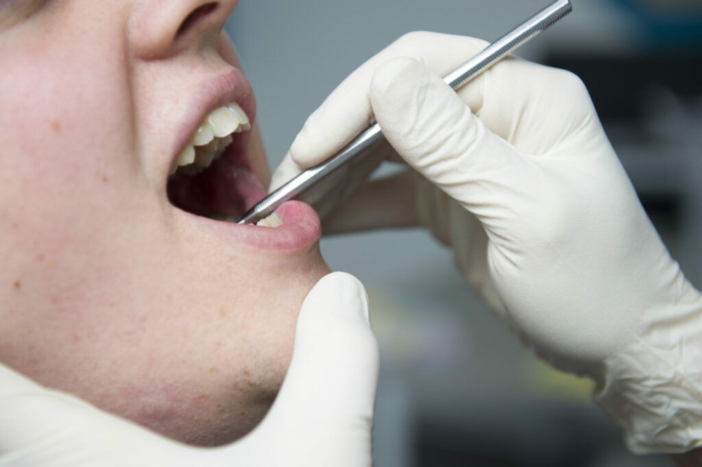 Antwerp offers free dental screening to vulnerable young people