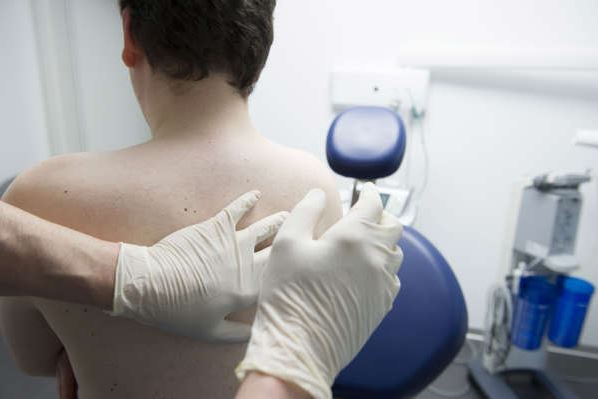 Belgian monkeypox vaccination strategy to change on Monday