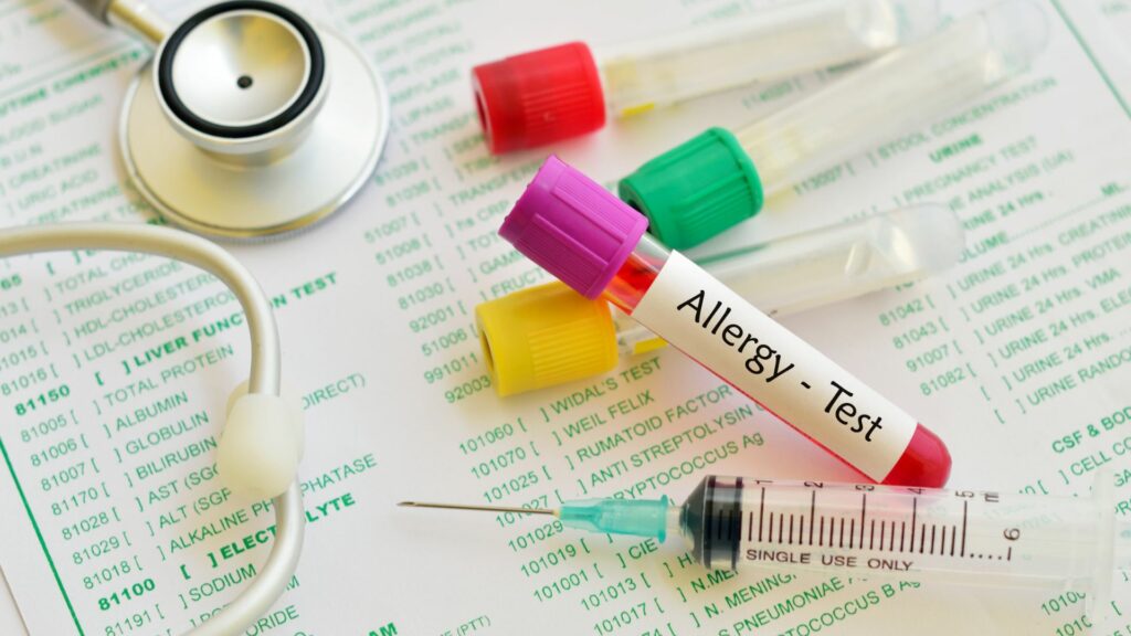 Supreme Health Council warns against pointless food allergy testing