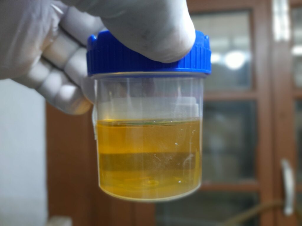 Urine could help reduce the environmental effects of synthetic fertilisers
