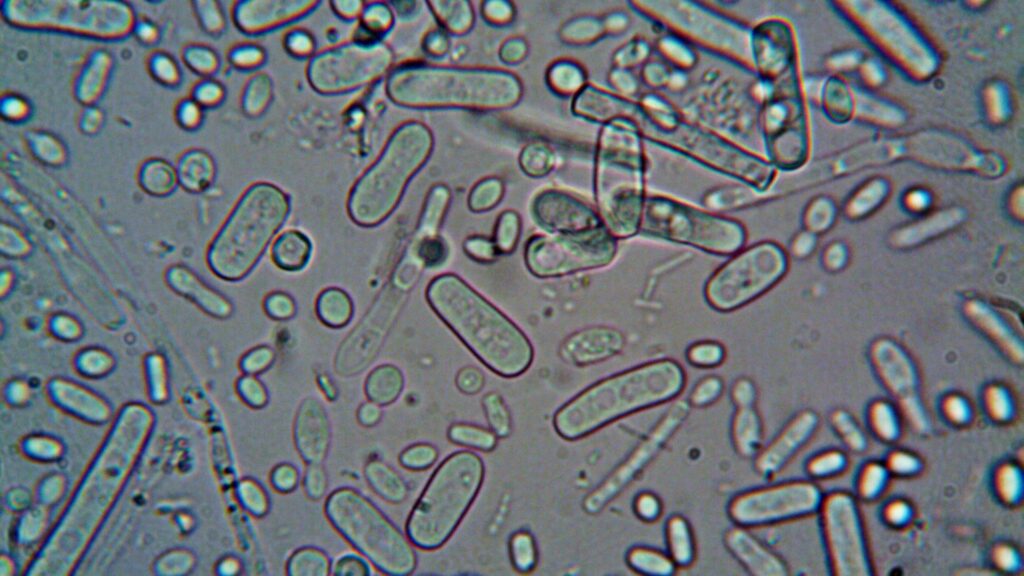 UN warns of link between pollution and drug-resistant superbugs