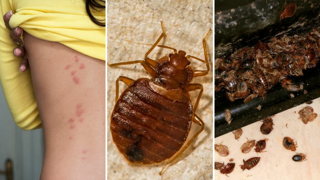 Bedbug hysteria: Belgian doctors sound the alarm