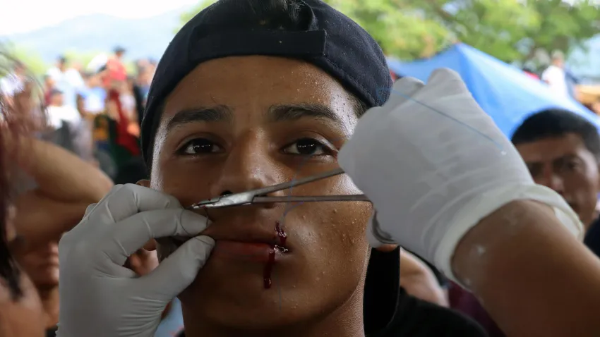 Mexico: Migrants sew their lips shut to press demands for transit permits