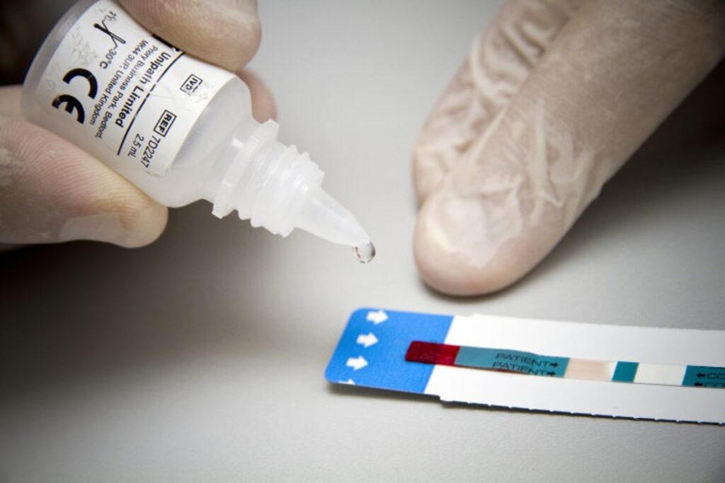 Teenage girls disproportionately affected by HIV worldwide