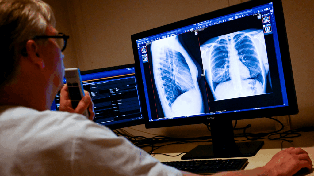 Tuberculosis outbreak at a primary school in Belgium