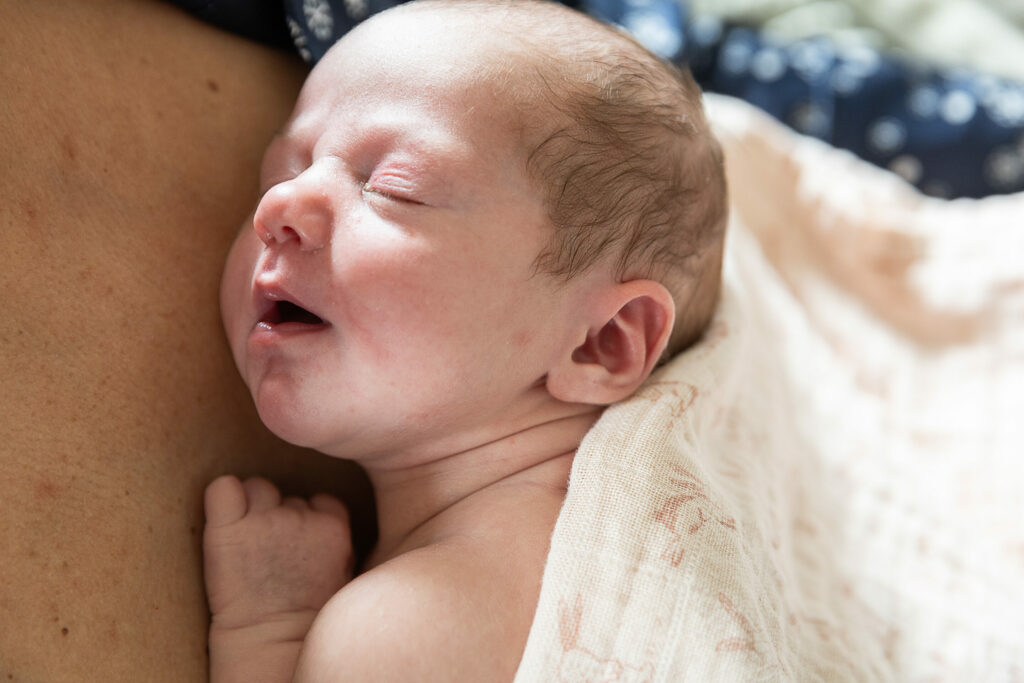 Brussels' breakthrough to treat babies with brain abnormalities