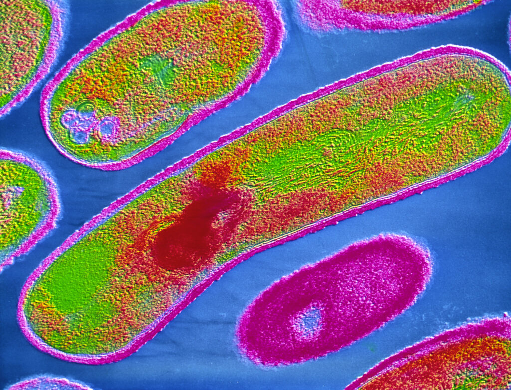 Record number of food-borne infections in Europe in 2023