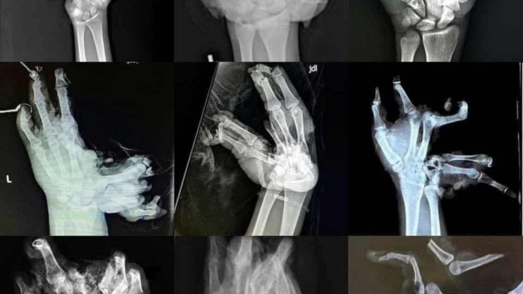 Brussels fire brigade calls on residents to obey firework ban