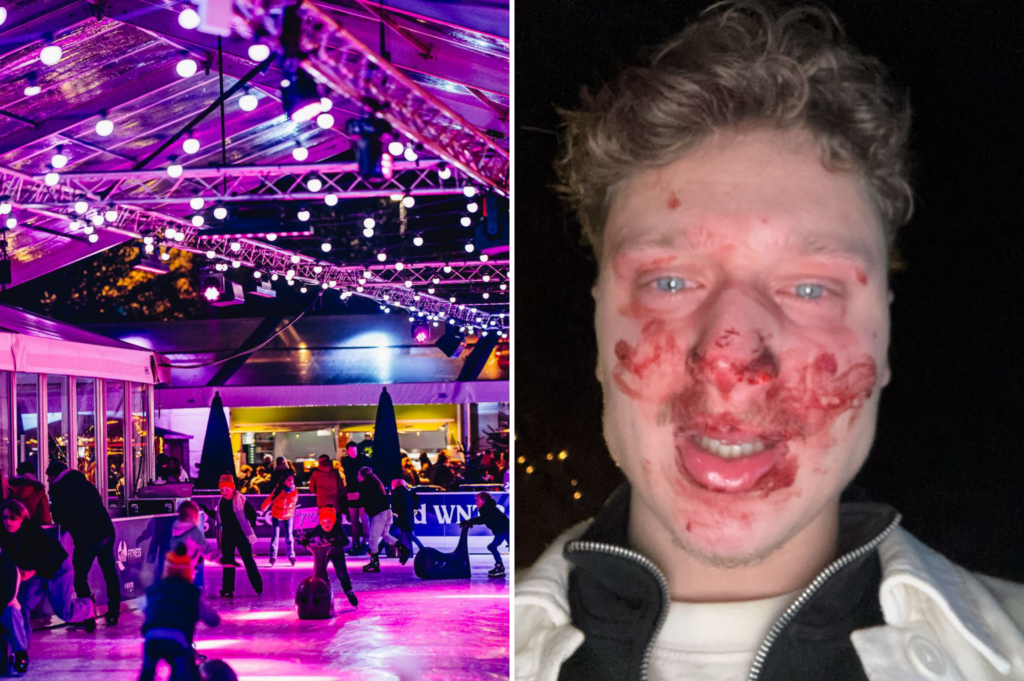 'I could only wait until they’d had enough': 24-year-old beaten after winter event near Antwerp