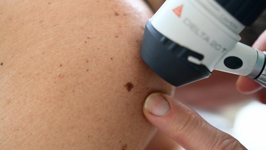 Belgian patients to access dermatologists faster through GP tele expertise scheme