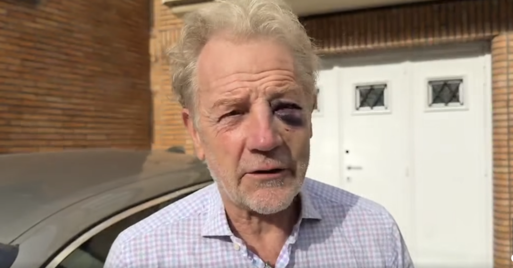 Man, 70, suffers fractured cheekbone after confronting scooter rider in Uccle
