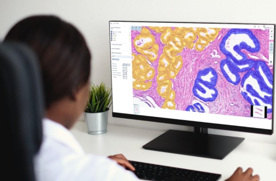 Finnish tech firm secures €20m from EU bank to boost AI in cancer detection