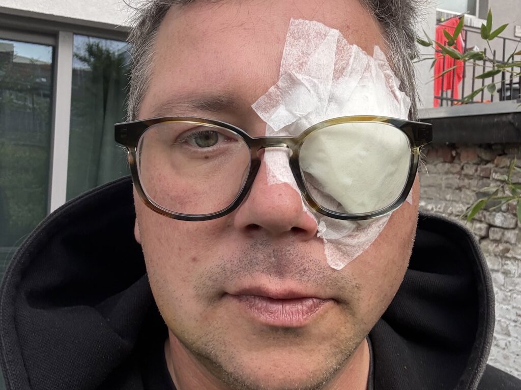 ‘I could have died’: Brussels cyclist might never regain sight in one eye after road rage attack